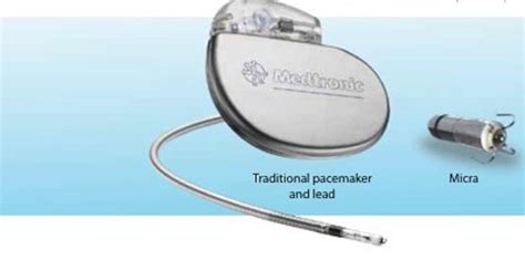 If you do not respond to an alert, the pump beeps every five minutes or every fifteen minutes, depending on the alert. . Medtronic pacemaker low battery alarm